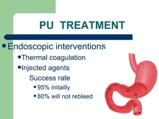 PU  TREATMENT Endoscopic interventions Thermal coagulation Injected agents Success rate 95% initailly 80% will not rebleed 