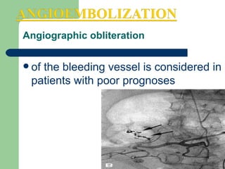 Angiographic obliteration of the bleeding vessel is considered in patients with poor prognoses  