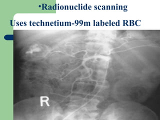 Radionuclide scanning  Uses technetium-99m labeled RBC 