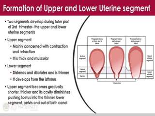 MANAGEMNET OF STAGES OF LABOUR and amtsl.pptx