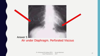 Dr. Mohamad Al-Gailani FRCS Acute Abdomen
Case Presentations 2017
23
Answer 5
Air under Diaphragm. Perforated Viscous
 