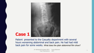Dr. Mohamad Al-Gailani FRCS Acute Abdomen
Case Presentations 2017
5
Case 1
Patient presented to the Casualty department with several
hours worsening abdominal and back pain. He had had mild
back pain for some weeks. What does the plain abdominal film show?
 