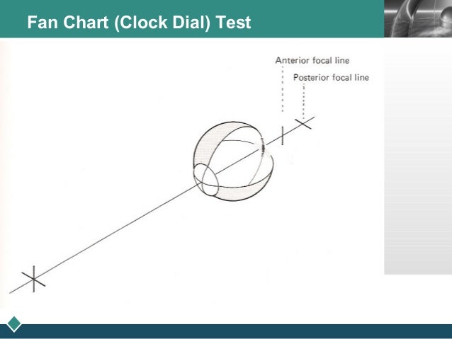 Clock Dial Test For Astigmatism