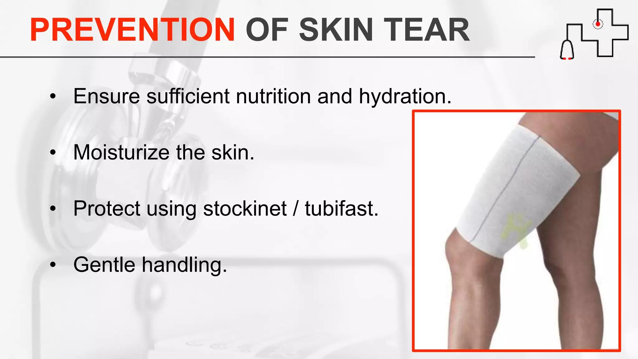 PREVENTION OF SKIN TEAR
• Ensure sufficient nutrition and hydration.
• Moisturize the skin.
• Protect using stockinet / tubifast.
• Gentle handling.
 