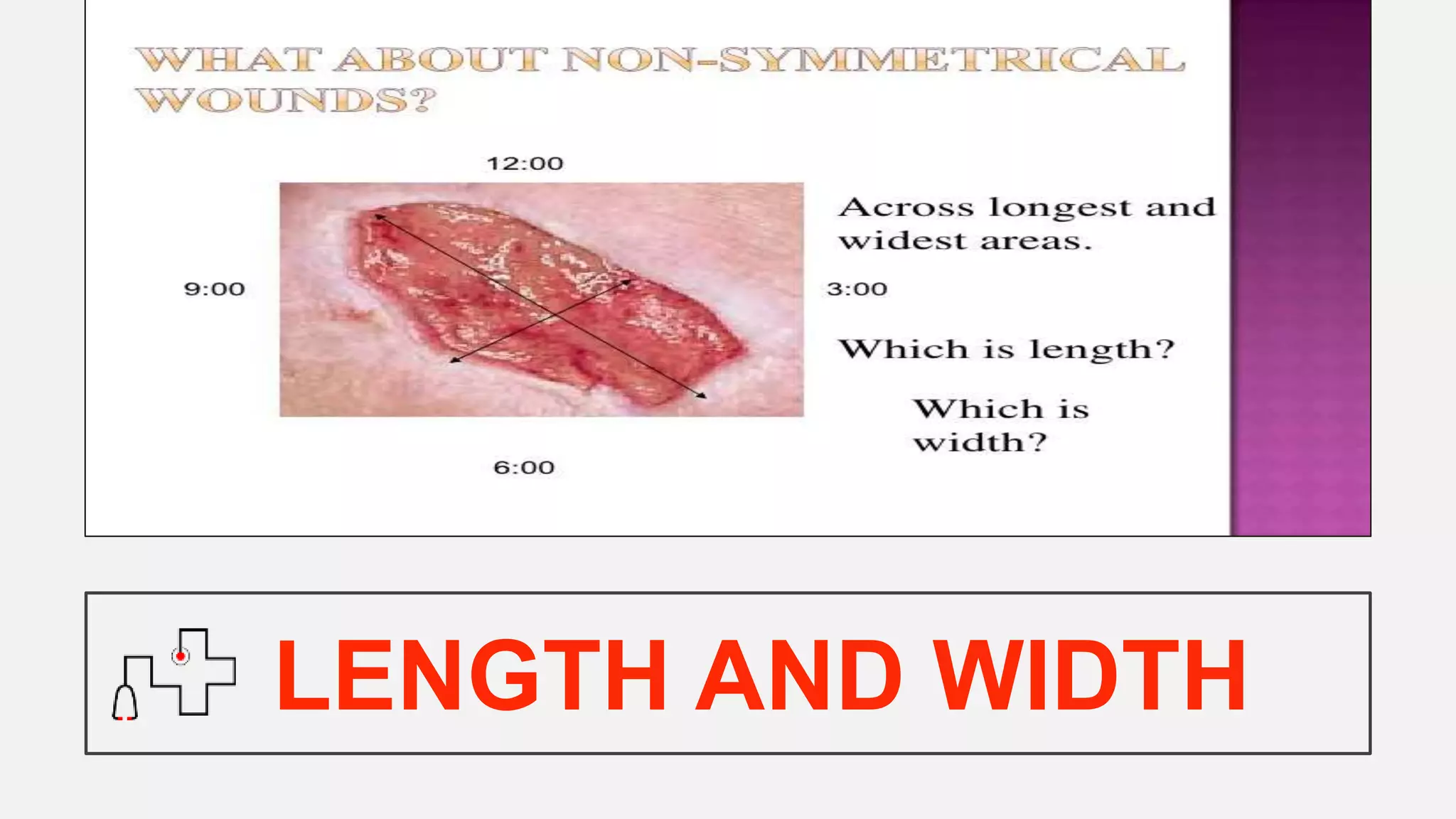 LENGTH AND WIDTH
 