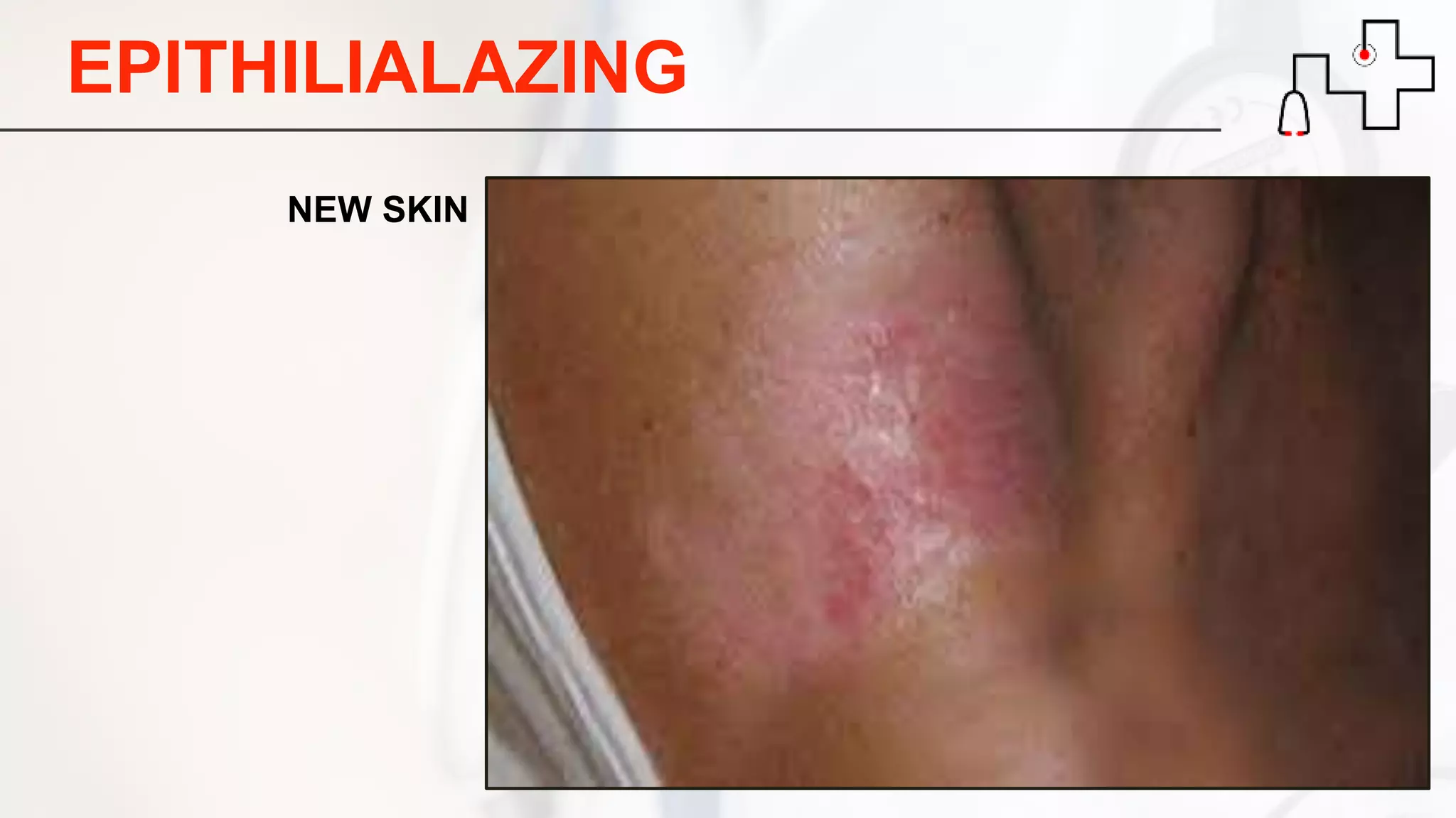 EPITHILIALAZING
NEW SKIN
 