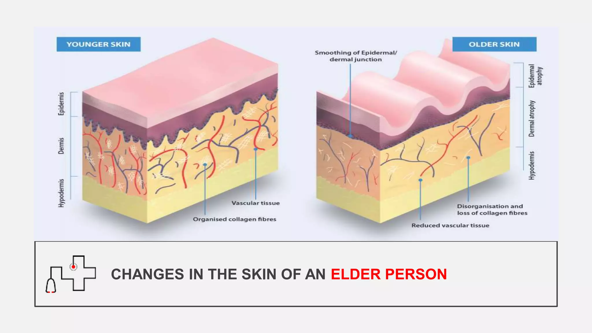 CHANGES IN THE SKIN OF AN ELDER PERSON
 