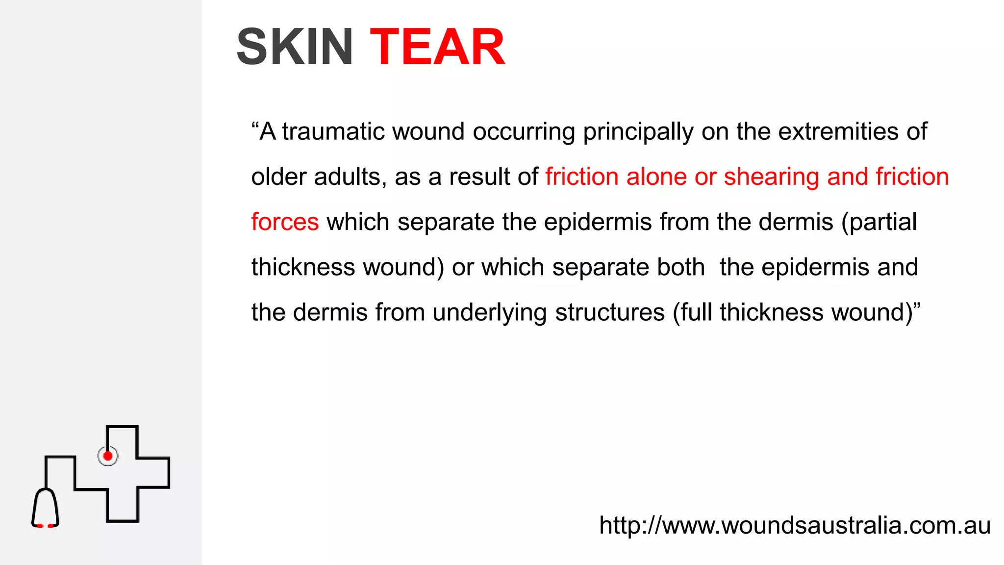 SKIN TEAR
“A traumatic wound occurring principally on the extremities of
older adults, as a result of friction alone or shearing and friction
forces which separate the epidermis from the dermis (partial
thickness wound) or which separate both the epidermis and
the dermis from underlying structures (full thickness wound)”
http://www.woundsaustralia.com.au
 