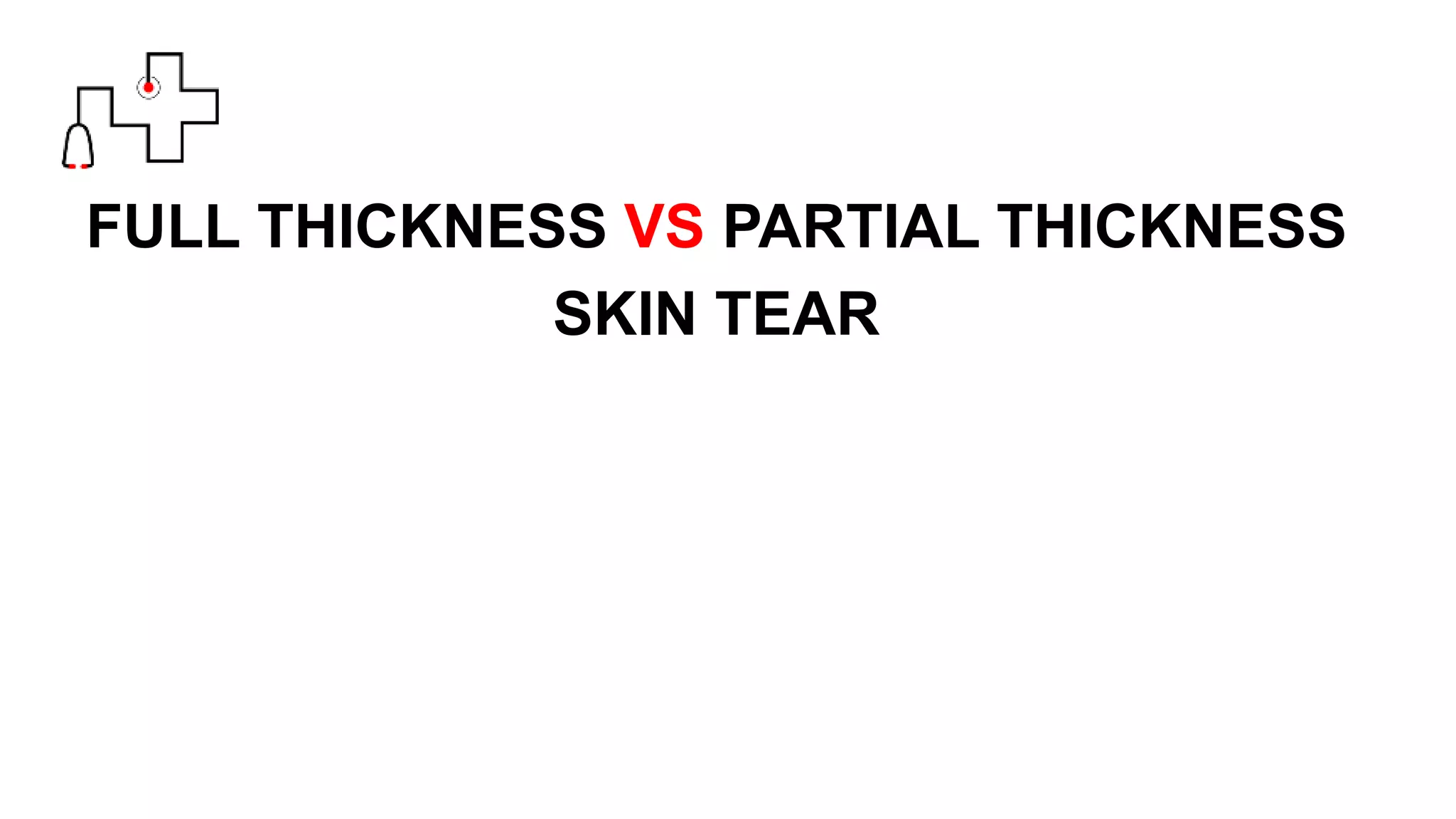 FULL THICKNESS VS PARTIAL THICKNESS
SKIN TEAR
 