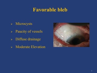 Managing bleb failure - A brief guide | PPTX