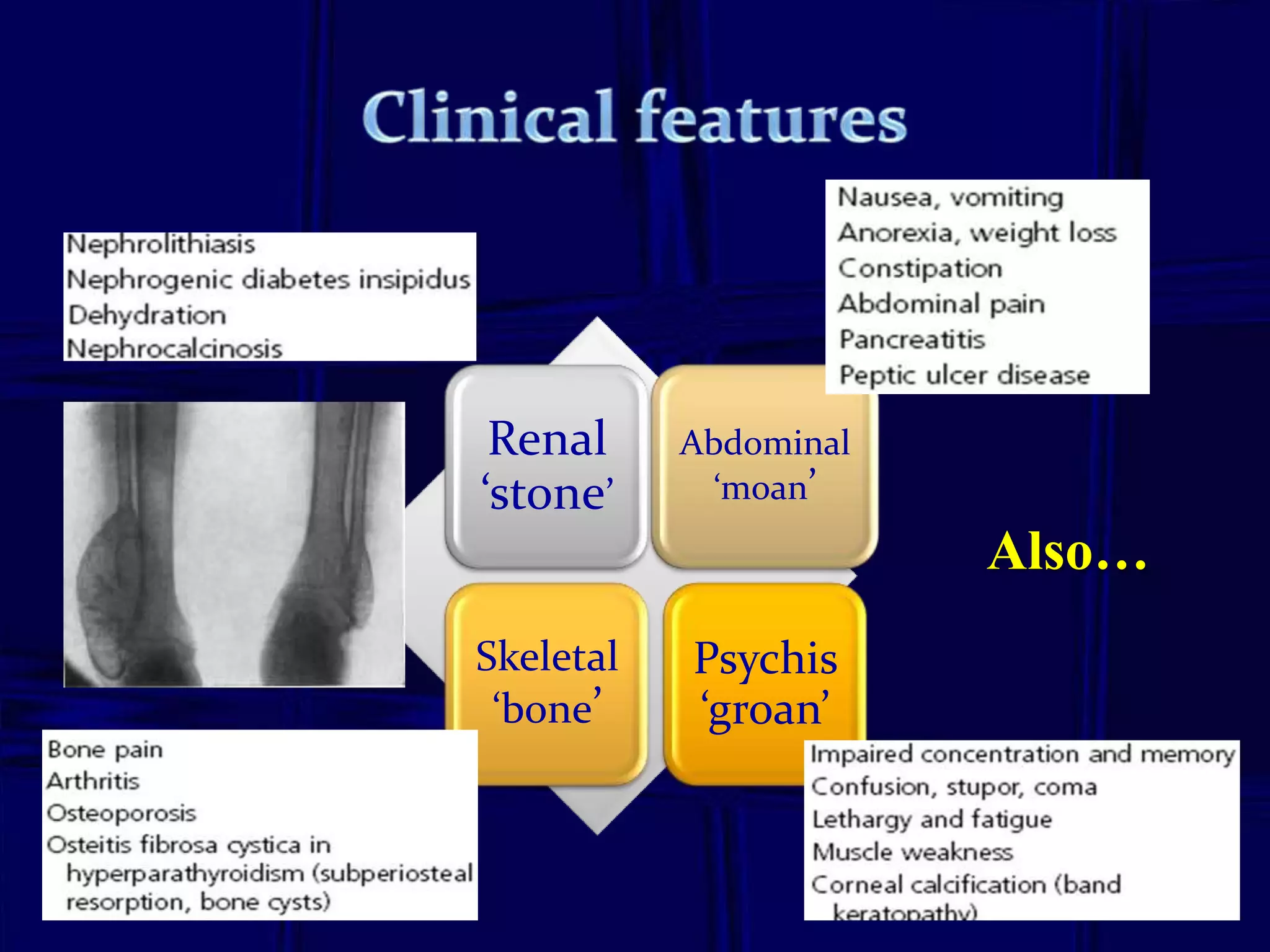Renal
‘stone’

Abdominal
‘moan’

Skeletal
‘bone’

Psychis
‘groan’

Also…

15

 
