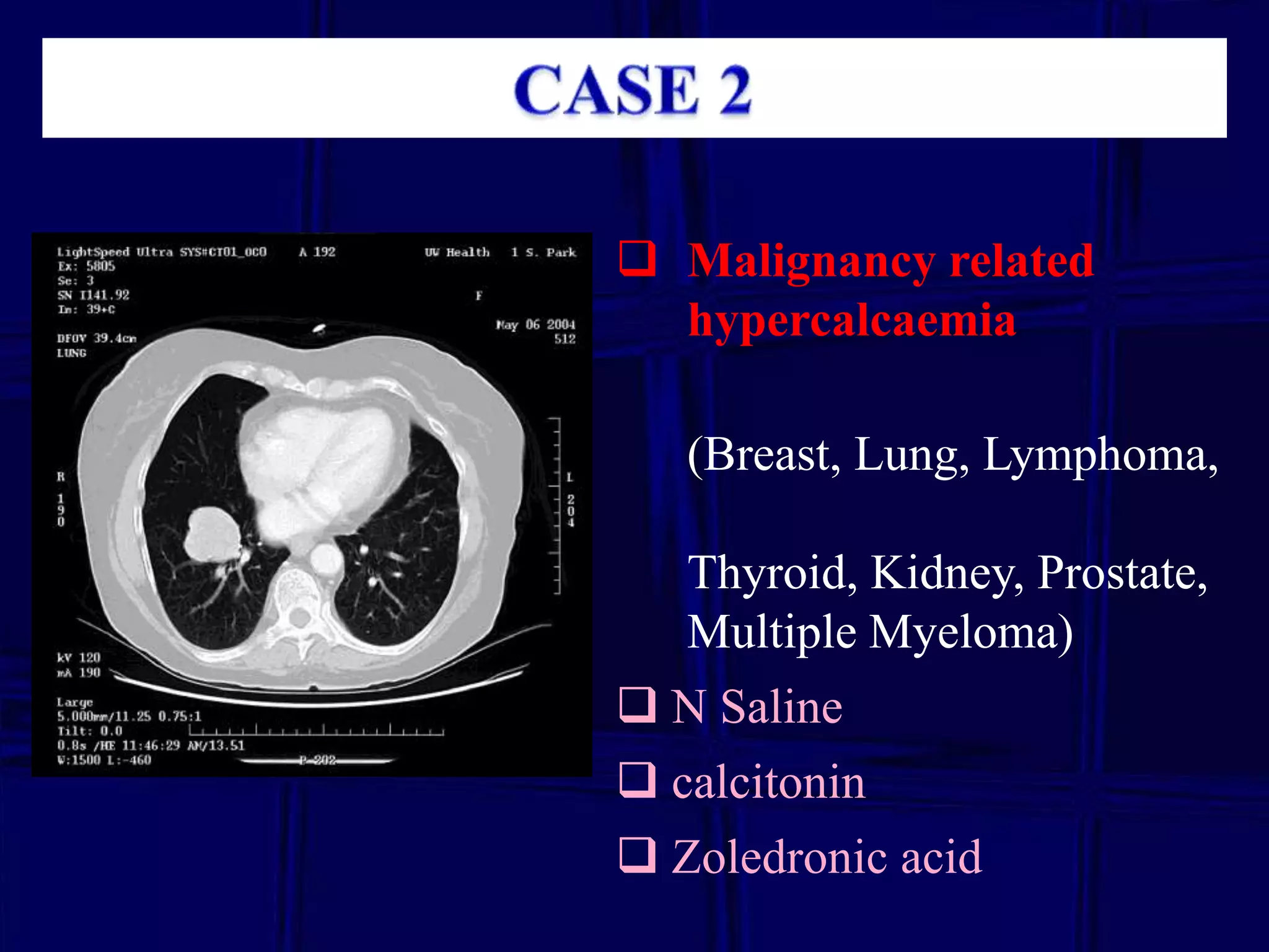  Malignancy related
hypercalcaemia
(Breast, Lung, Lymphoma,
Thyroid, Kidney, Prostate,
Multiple Myeloma)
 N Saline

 calcitonin
 Zoledronic acid

 