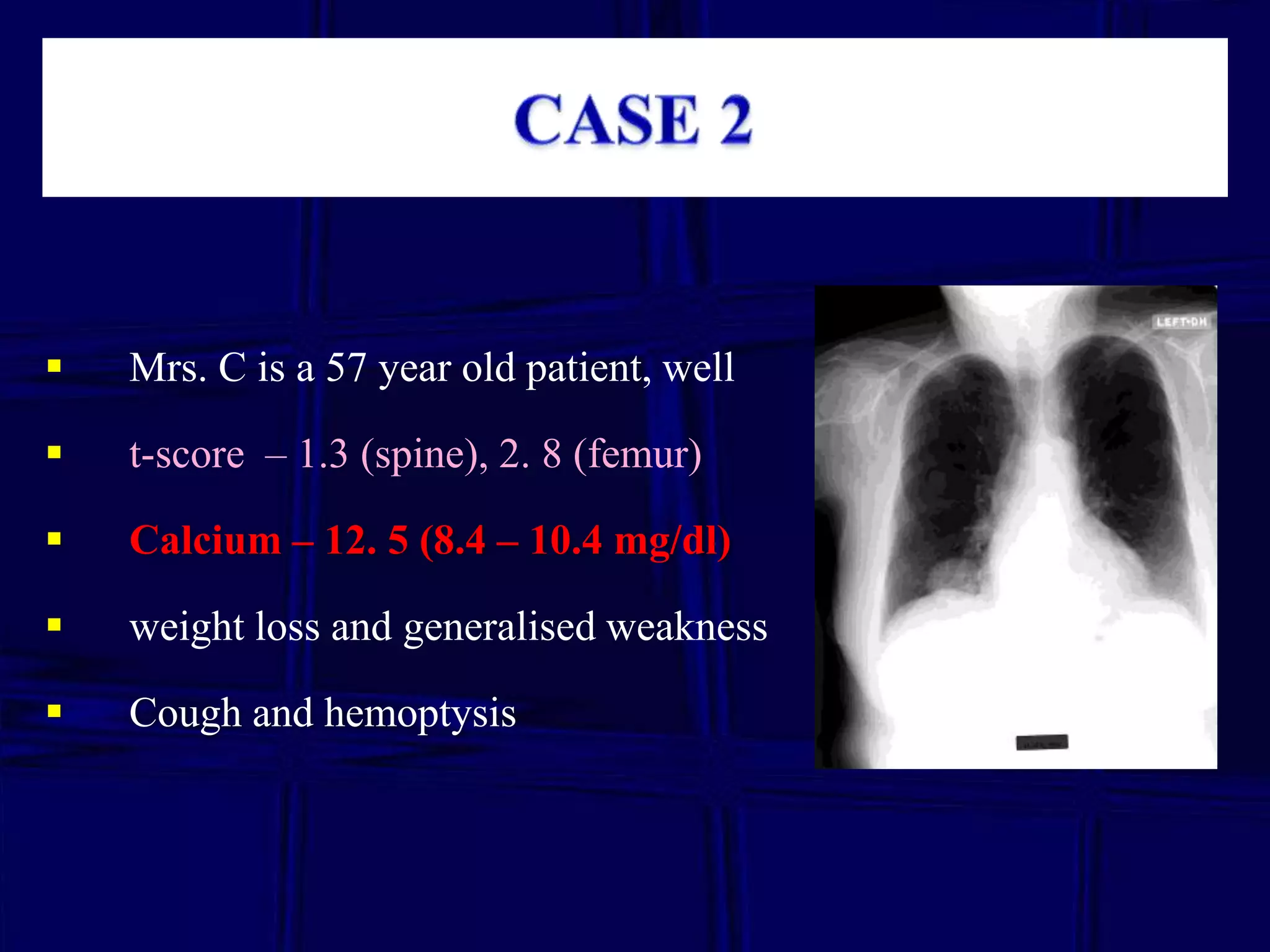 

Mrs. C is a 57 year old patient, well



t-score – 1.3 (spine), 2. 8 (femur)



Calcium – 12. 5 (8.4 – 10.4 mg/dl)



weight loss and generalised weakness



Cough and hemoptysis

 