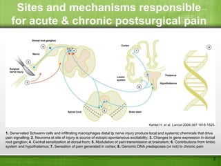 Sites and mechanisms responsible
   for acute & chronic postsurgical pain




                                                                                          Kehlet H, et al. Lancet 2006;367:1618-1625.

1. Denervated Schwann cells and infiltrating macrophages distal tp nerve injury produce local and systemic chemicals that drive
pain signalling; 2. Neuroma at site of injury is source of ectopic spontaneous excitability; 3. Changes in gene expression in dorsal
root ganglion; 4. Central sensitization at dorsal horn; 5. Modulation of pain transmission at brainstem; 6. Contributions from limbic
system and hypothalamus; 7. Sensation of pain generated in cortex; 8. Genomic DNA predisposes (or not) to chronic pain


                                                                                                                                   2
 