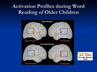 Activation Profiles during Word Reading of Older Children 
