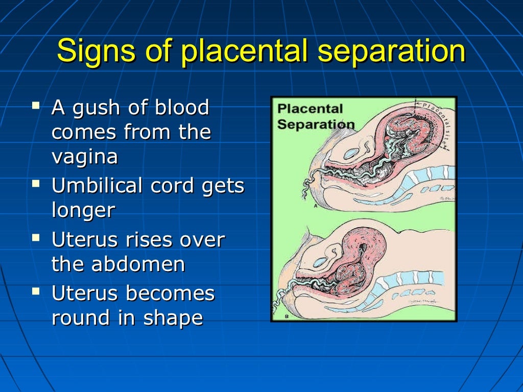 Managing the 3rd stage of labor, dr.rhodora cruz,bulacan ob g