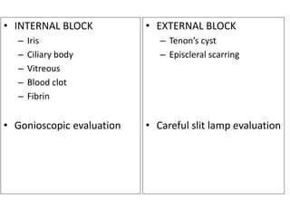 • INTERNAL BLOCK
– Iris
– Ciliary body
– Vitreous
– Blood clot
– Fibrin
• Gonioscopic evaluation
• EXTERNAL BLOCK
– Tenon’s cyst
– Episcleral scarring
• Careful slit lamp evaluation
 