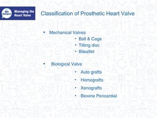 Classification of Prosthetic Heart Valve
• Mechanical Valves
• Ball & Cage
• Tilting disc
• Bileaflet
• Biological Valve
• Auto grafts
• Homografts
• Xenografts
• Biovine Pericardial
 