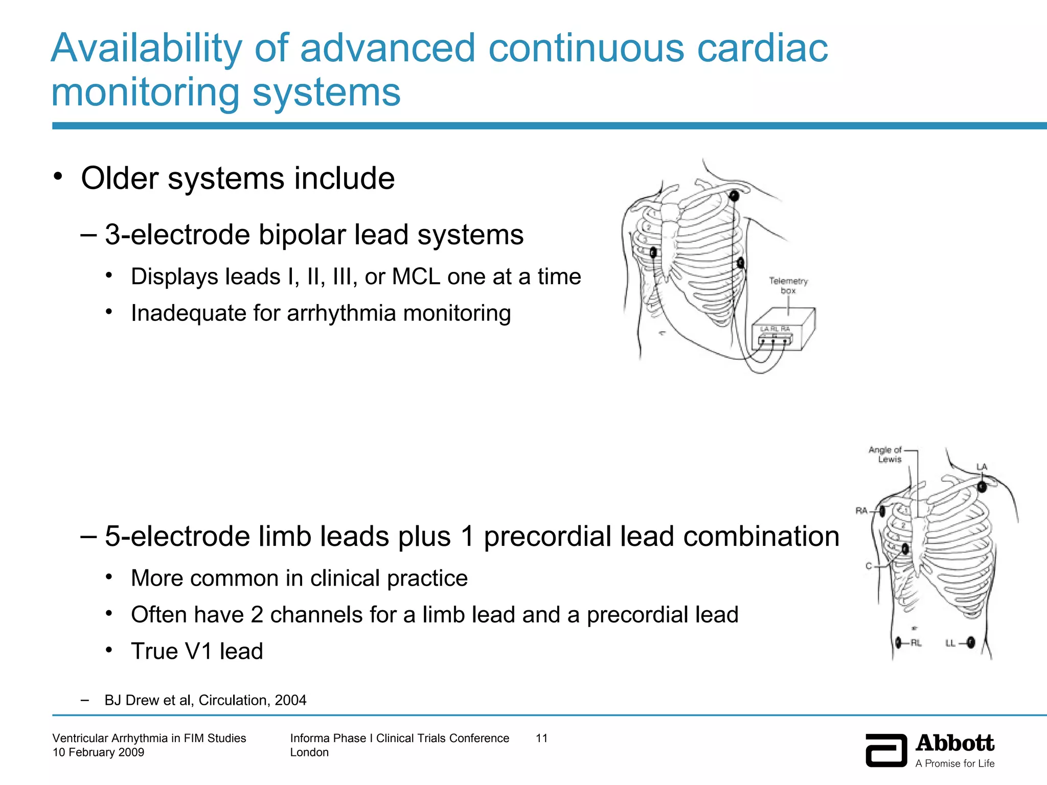 Availability of advanced continuous cardiac monitoring systems Older systems include 3-electrode bipolar lead systems Displays leads I, II, III, or MCL one at a time Inadequate for arrhythmia monitoring 5-electrode limb leads plus 1 precordial lead combination More common in clinical practice Often have 2 channels for a limb lead and a precordial lead True V1 lead BJ Drew et al, Circulation, 2004 
