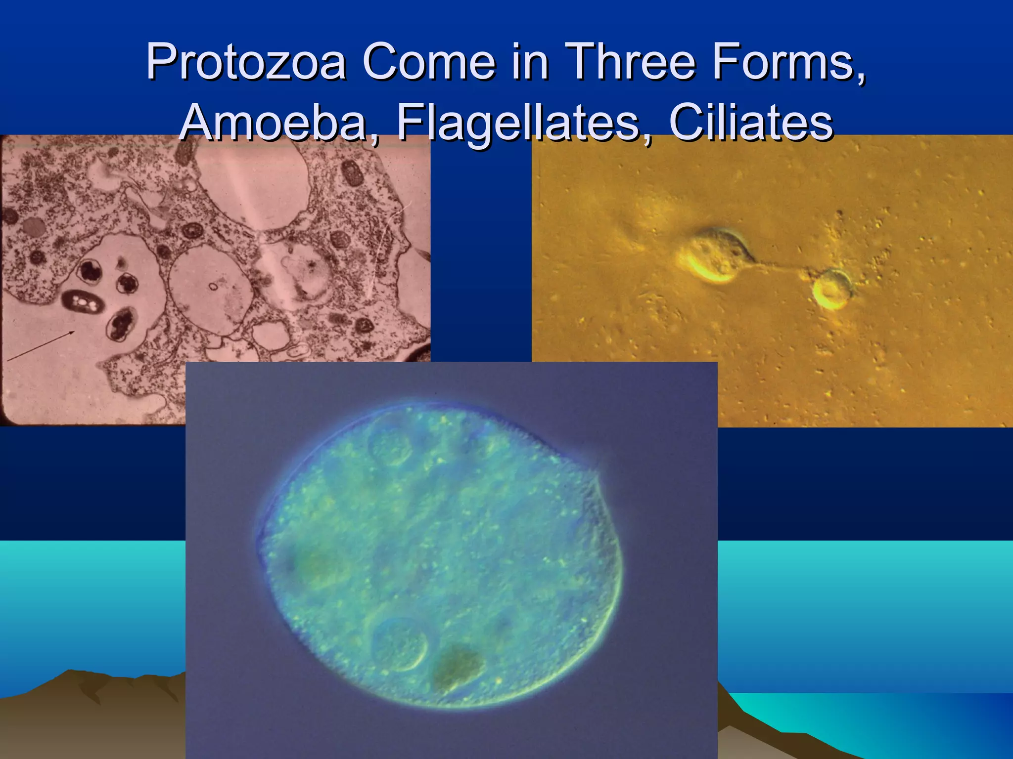 Protozoa Come in Three Forms,
 Amoeba, Flagellates, Ciliates
 