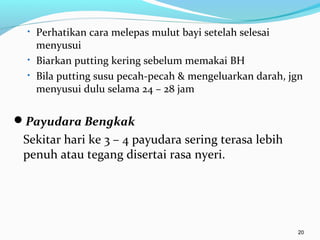 • Perhatikan cara melepas mulut bayi setelah selesai
menyusui
• Biarkan putting kering sebelum memakai BH
• Bila putting susu pecah-pecah & mengeluarkan darah, jgn
menyusui dulu selama 24 – 28 jam
Payudara Bengkak
Sekitar hari ke 3 – 4 payudara sering terasa lebih
penuh atau tegang disertai rasa nyeri.
20
 