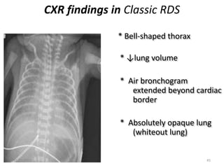Cxr In Rds Managment of common neonatal problems | PPTX