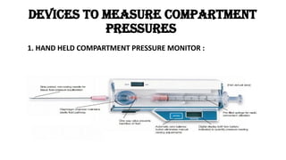 Managment of compartment syndrome. pptx | PPTX