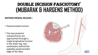 Longitudinal Incision Leg Managment of compartment syndrome. pptx | PPTX