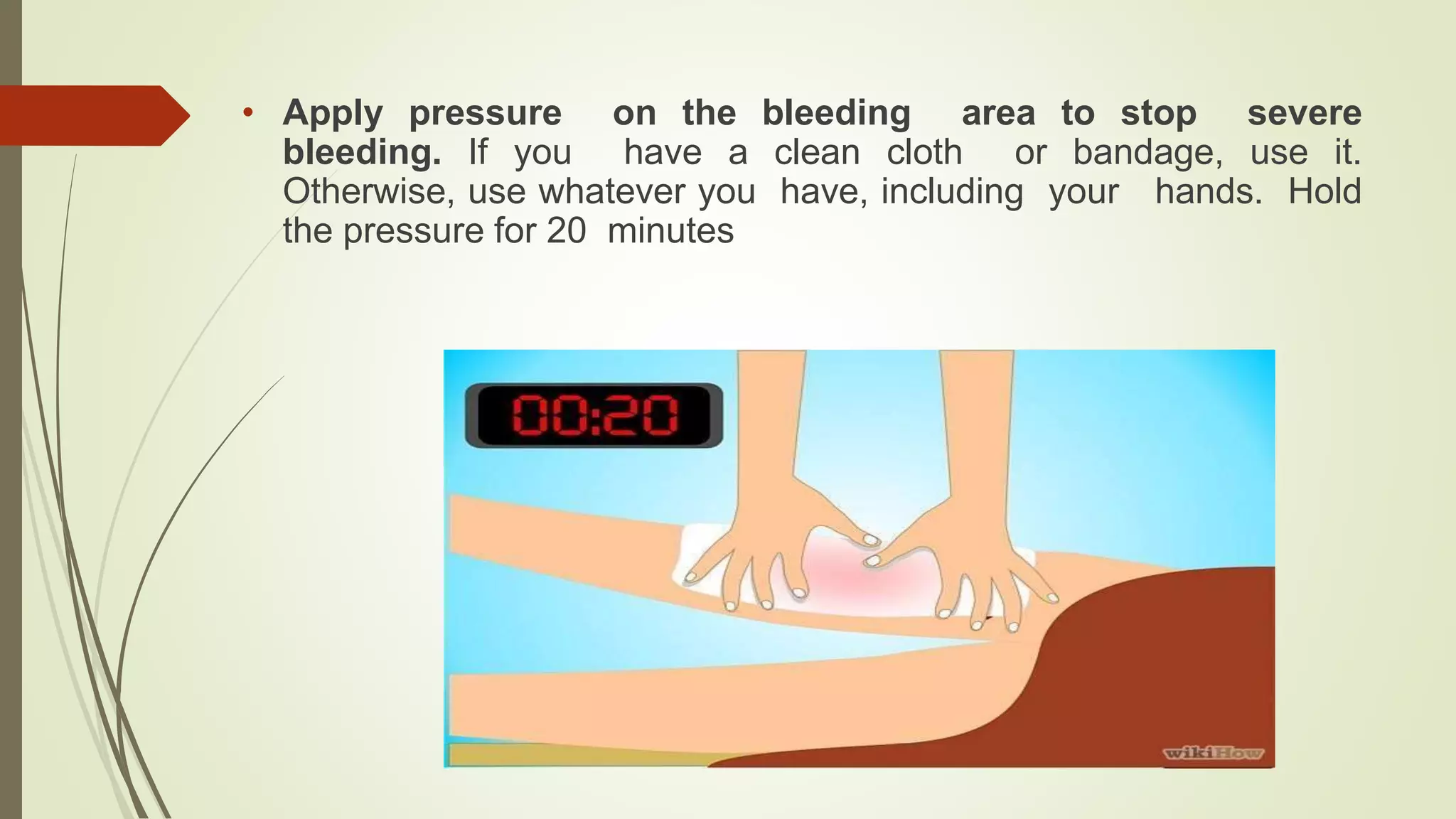 Managment of external venous | PPTX