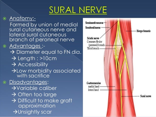 Sural nerve root tumor