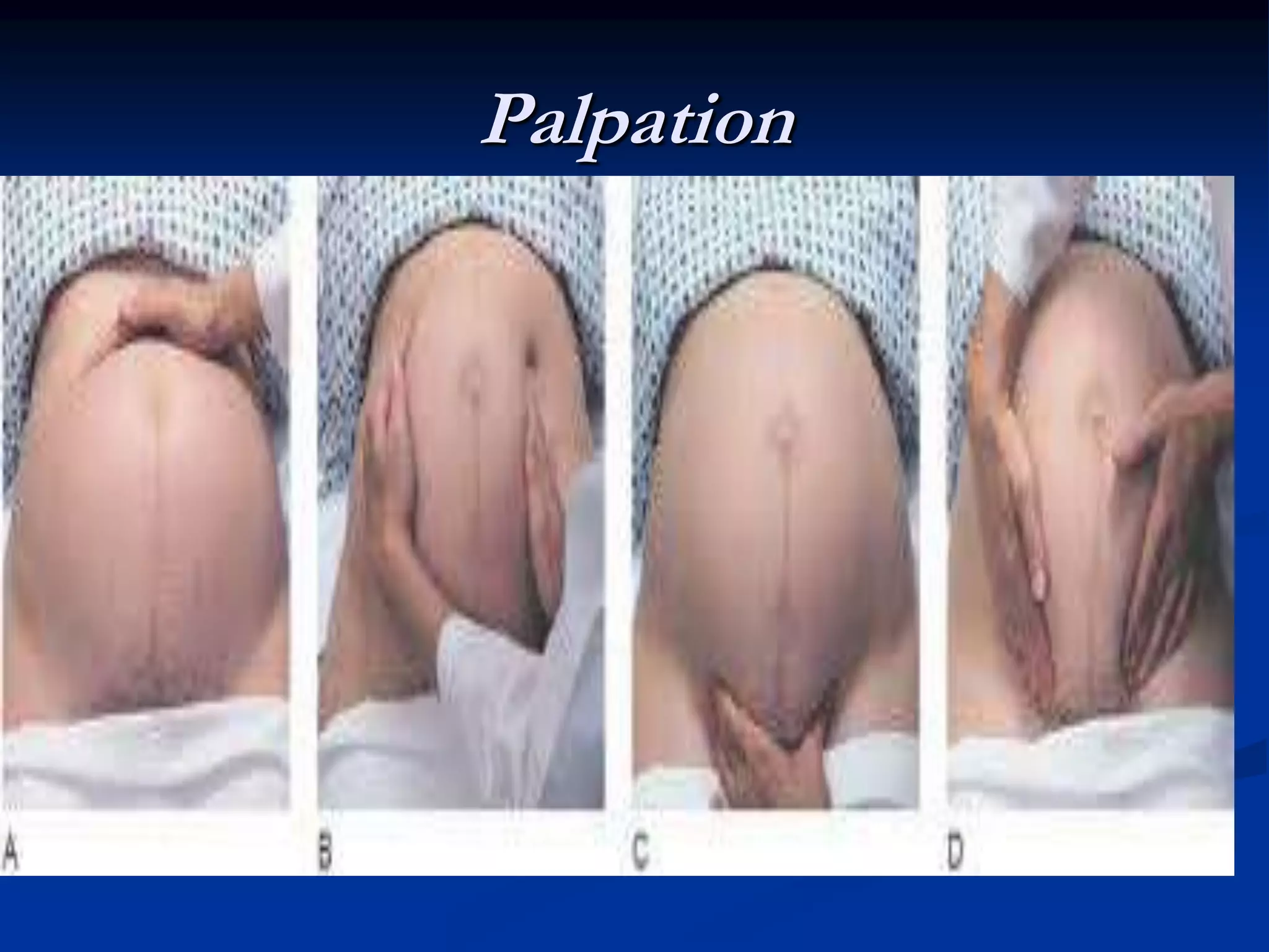 Palpation
 