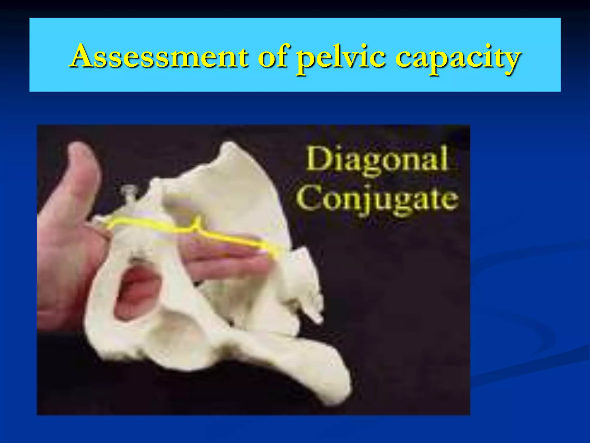 Assessment of pelvic capacity
 