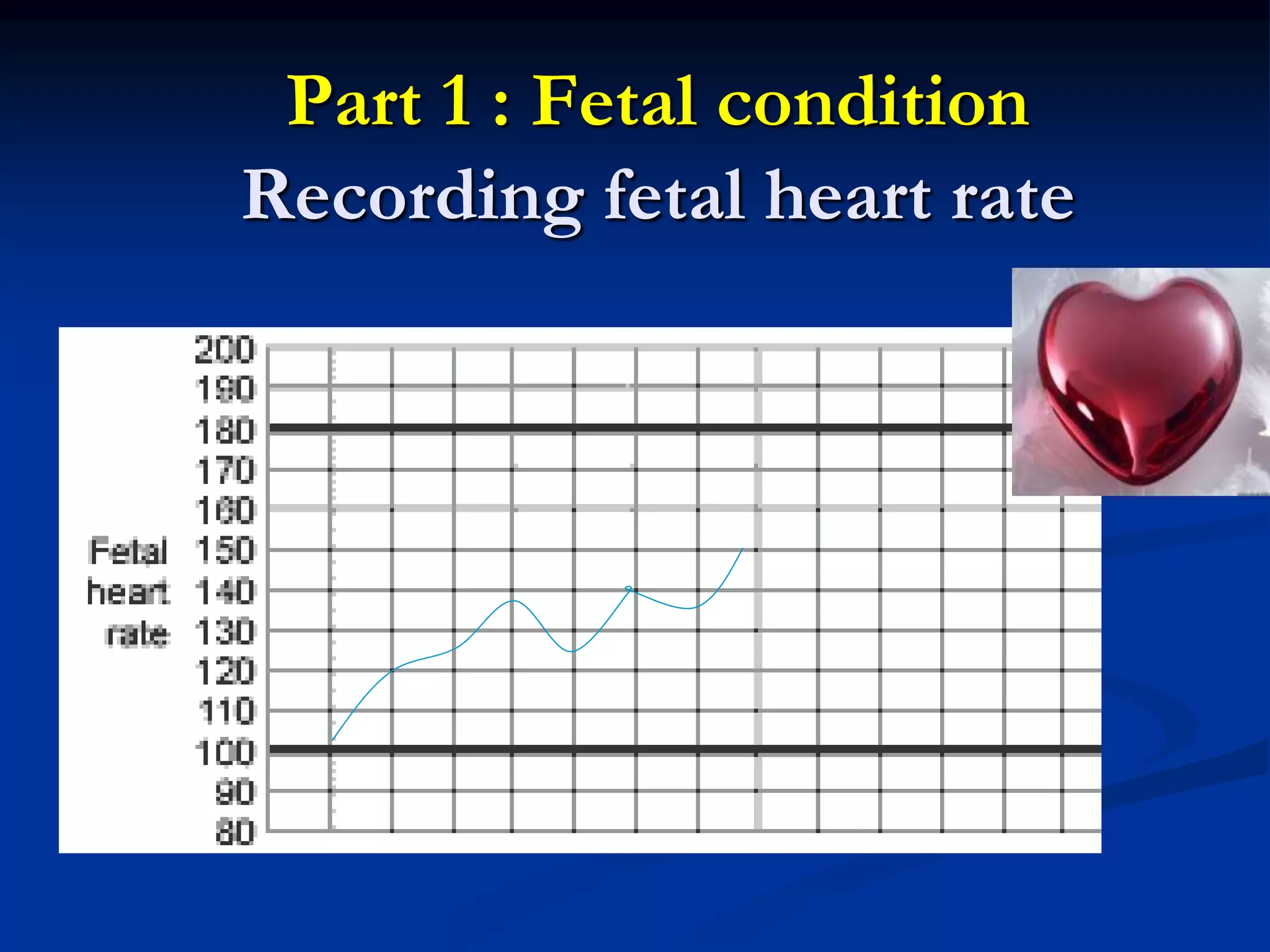Part 1 : Fetal condition
Recording fetal heart rate
 