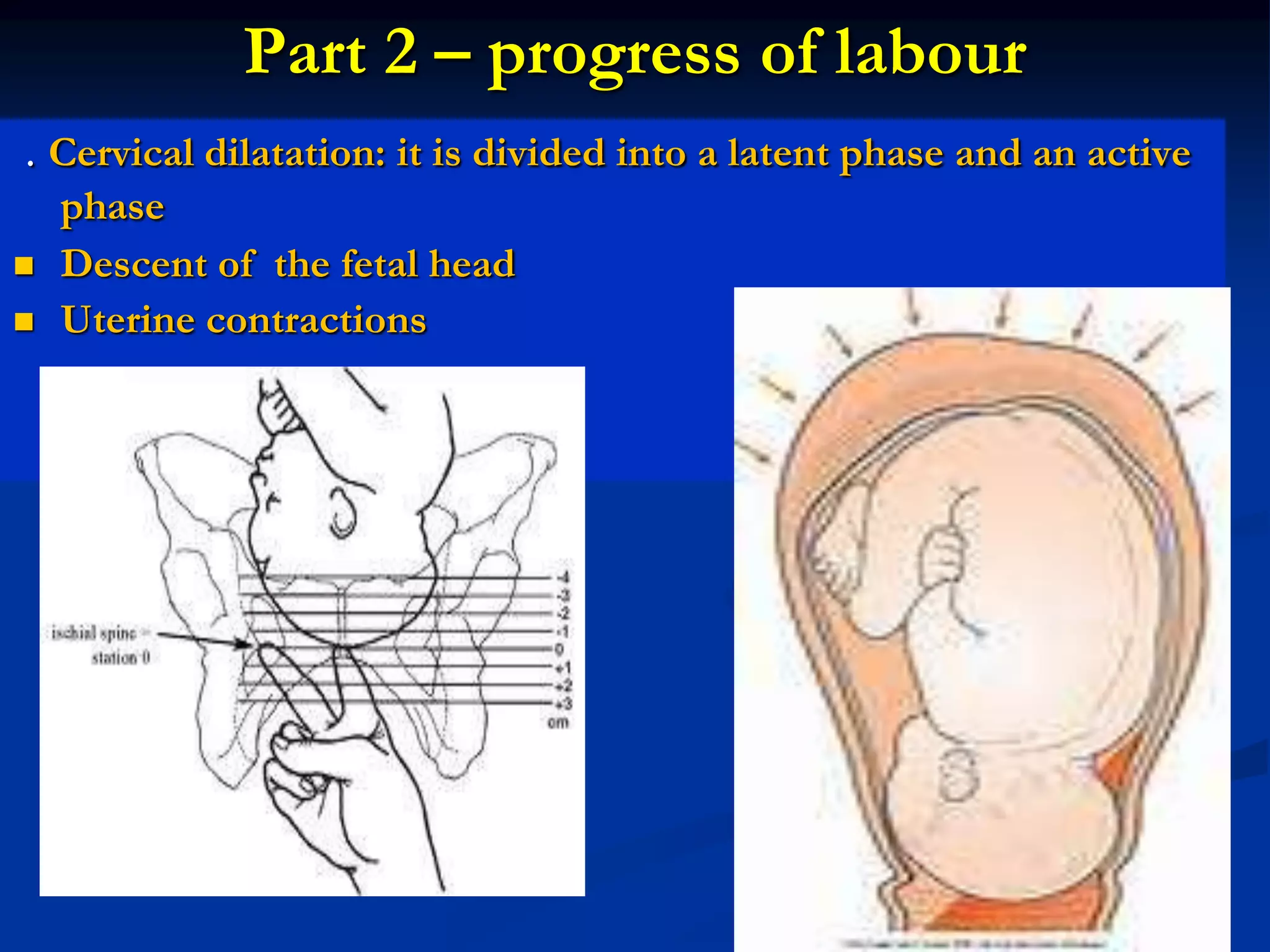 Part 2 – progress of labour
. Cervical dilatation: it is divided into a latent phase and an active
phase
 Descent of the fetal head
 Uterine contractions
 
