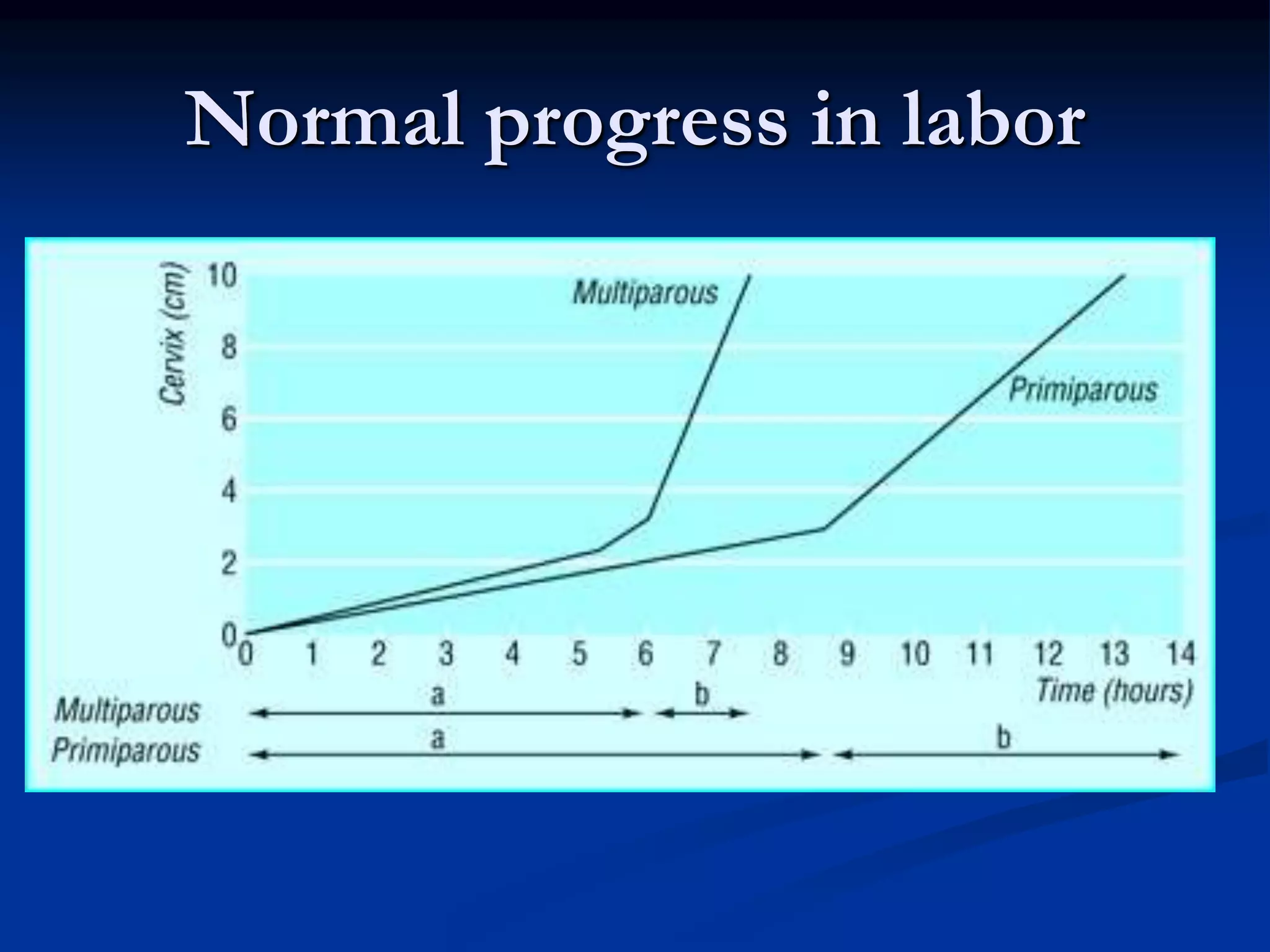 Normal progress in labor
 