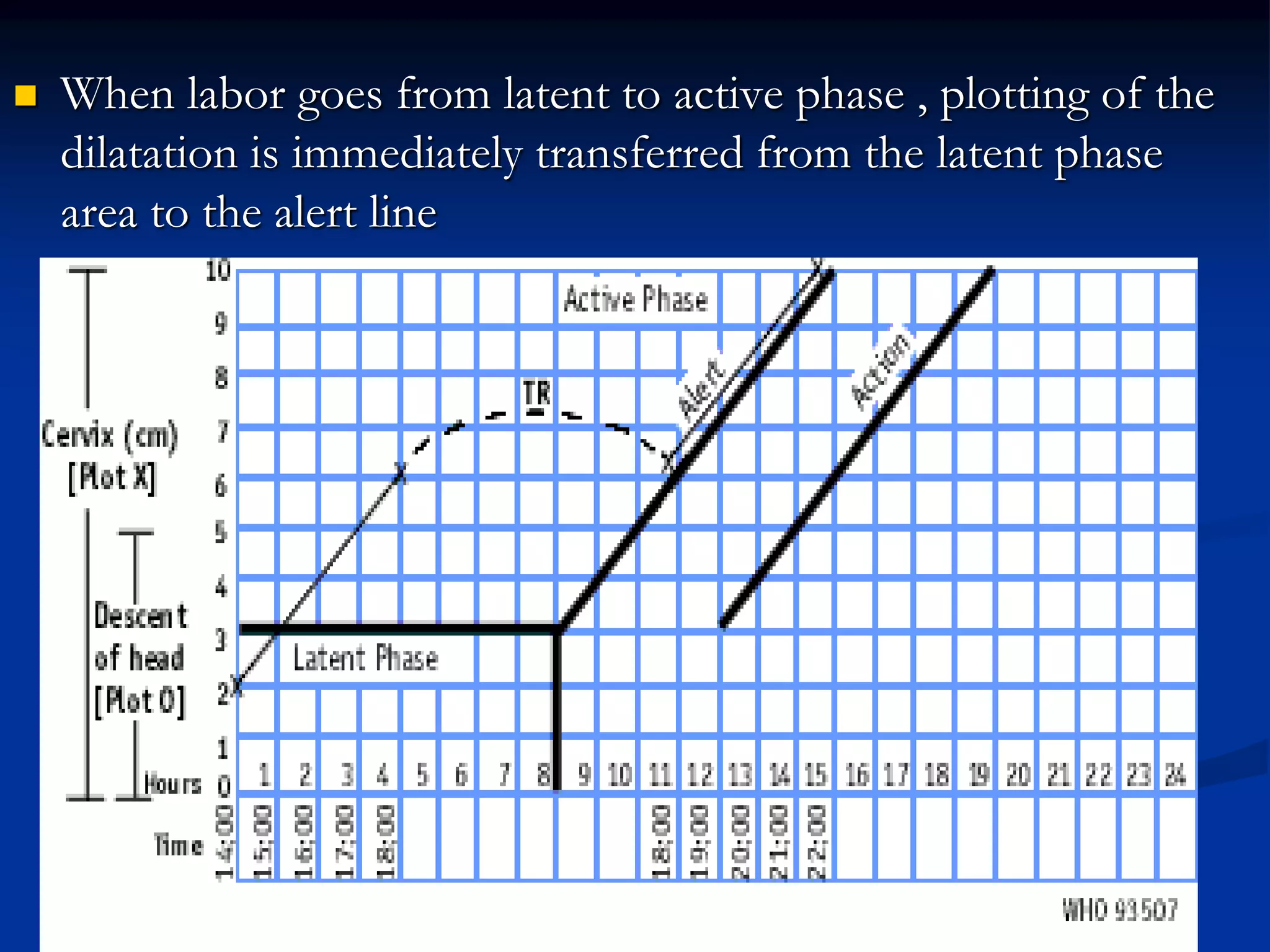  When labor goes from latent to active phase , plotting of the
dilatation is immediately transferred from the latent phase
area to the alert line
 