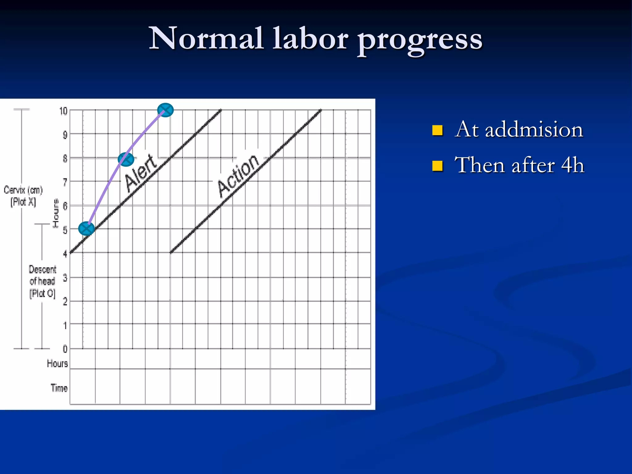 Normal labor progress
 At addmision
 Then after 4h
 
