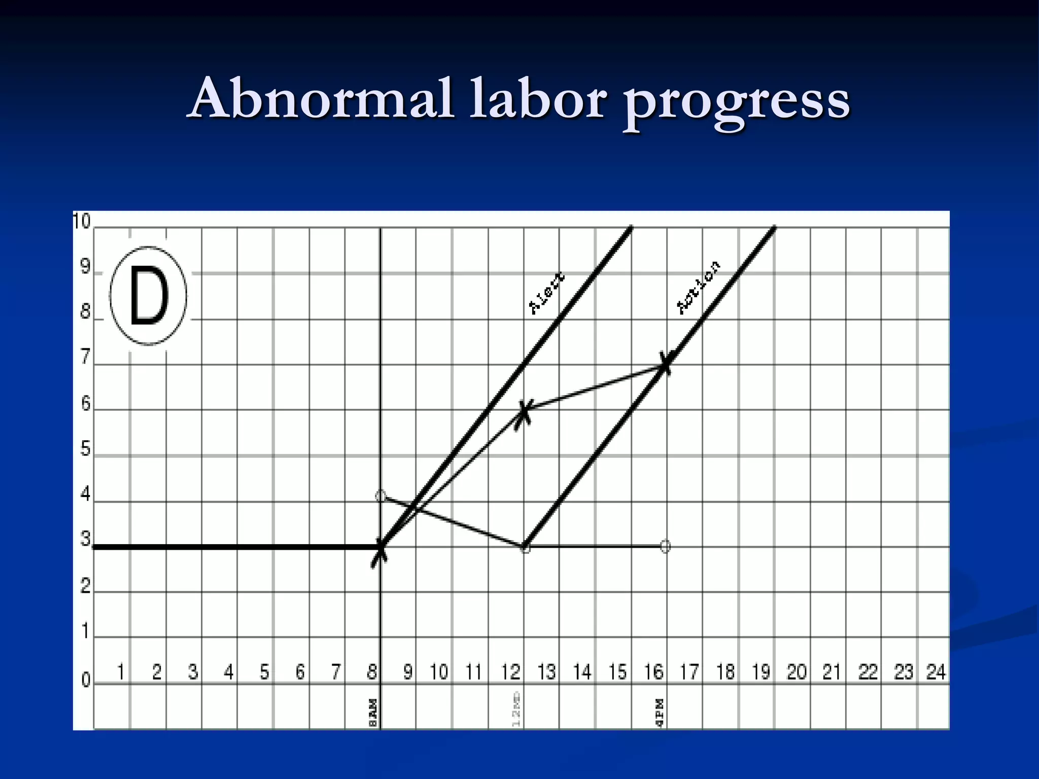 Abnormal labor progress
 