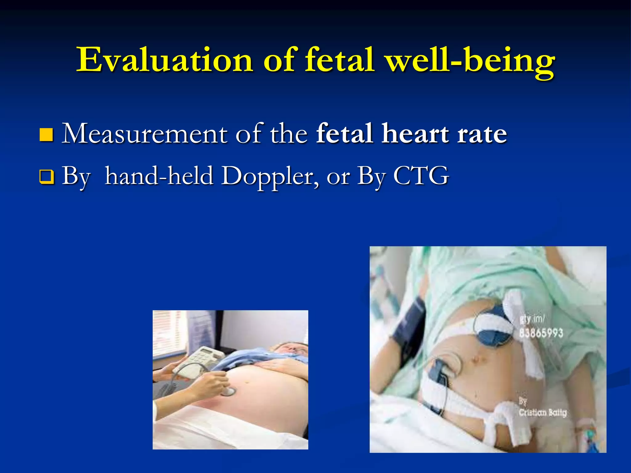 Evaluation of fetal well-being
 Measurement of the fetal heart rate
 By hand-held Doppler, or By CTG
 