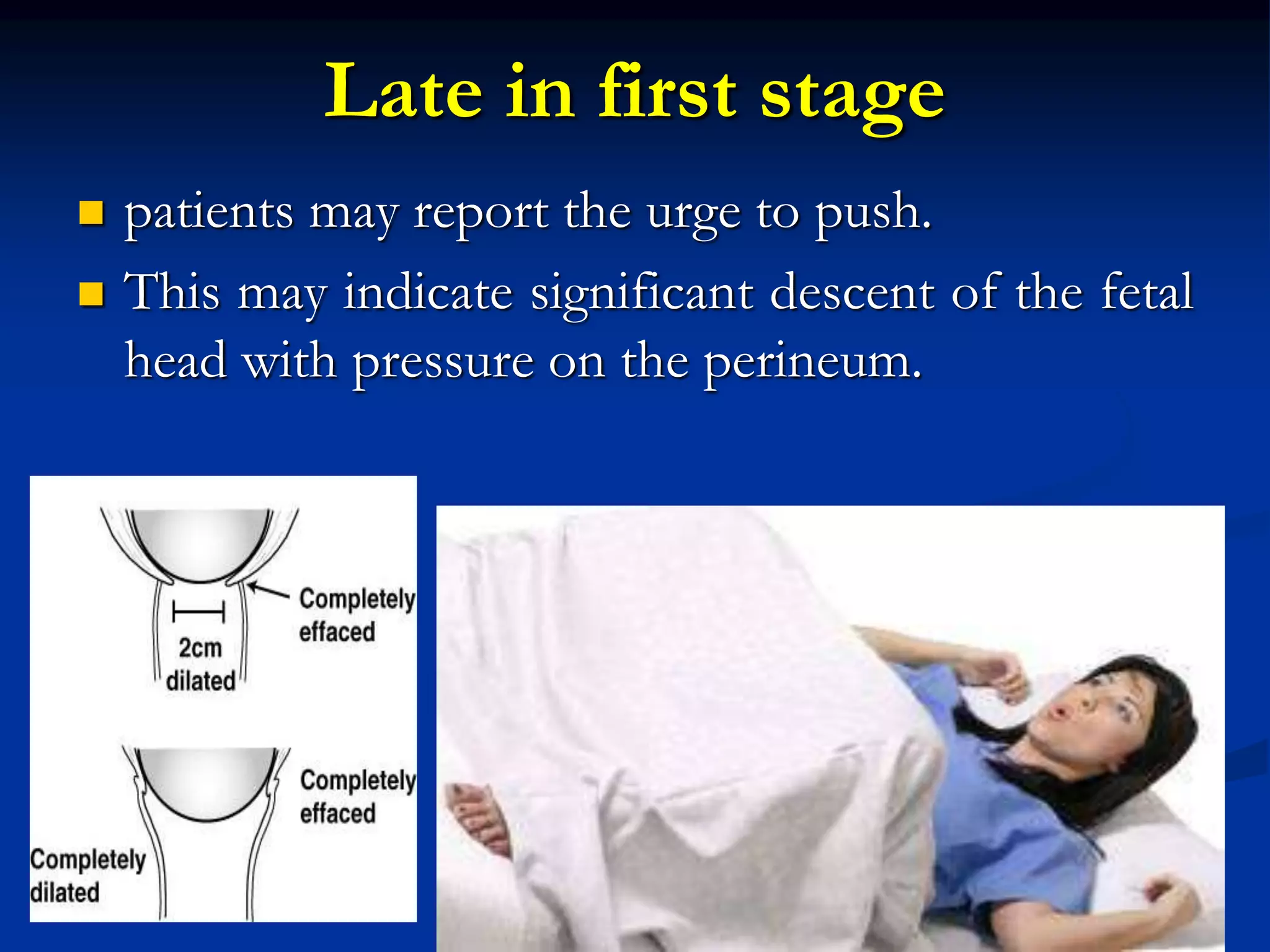 Late in first stage
 patients may report the urge to push.
 This may indicate significant descent of the fetal
head with pressure on the perineum.
 