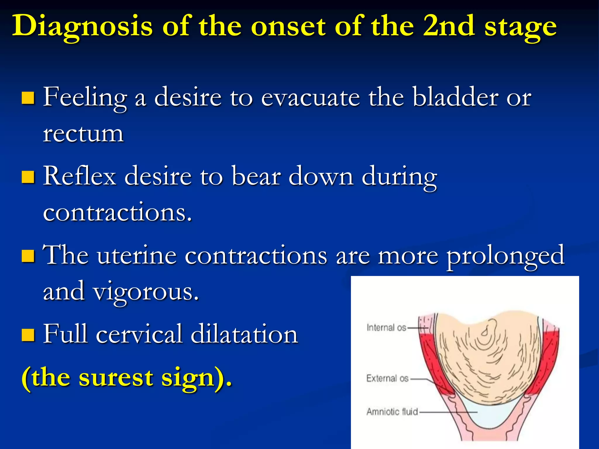 Diagnosis of the onset of the 2nd stage
 Feeling a desire to evacuate the bladder or
rectum
 Reflex desire to bear down during
contractions.
 The uterine contractions are more prolonged
and vigorous.
 Full cervical dilatation
(the surest sign).
 