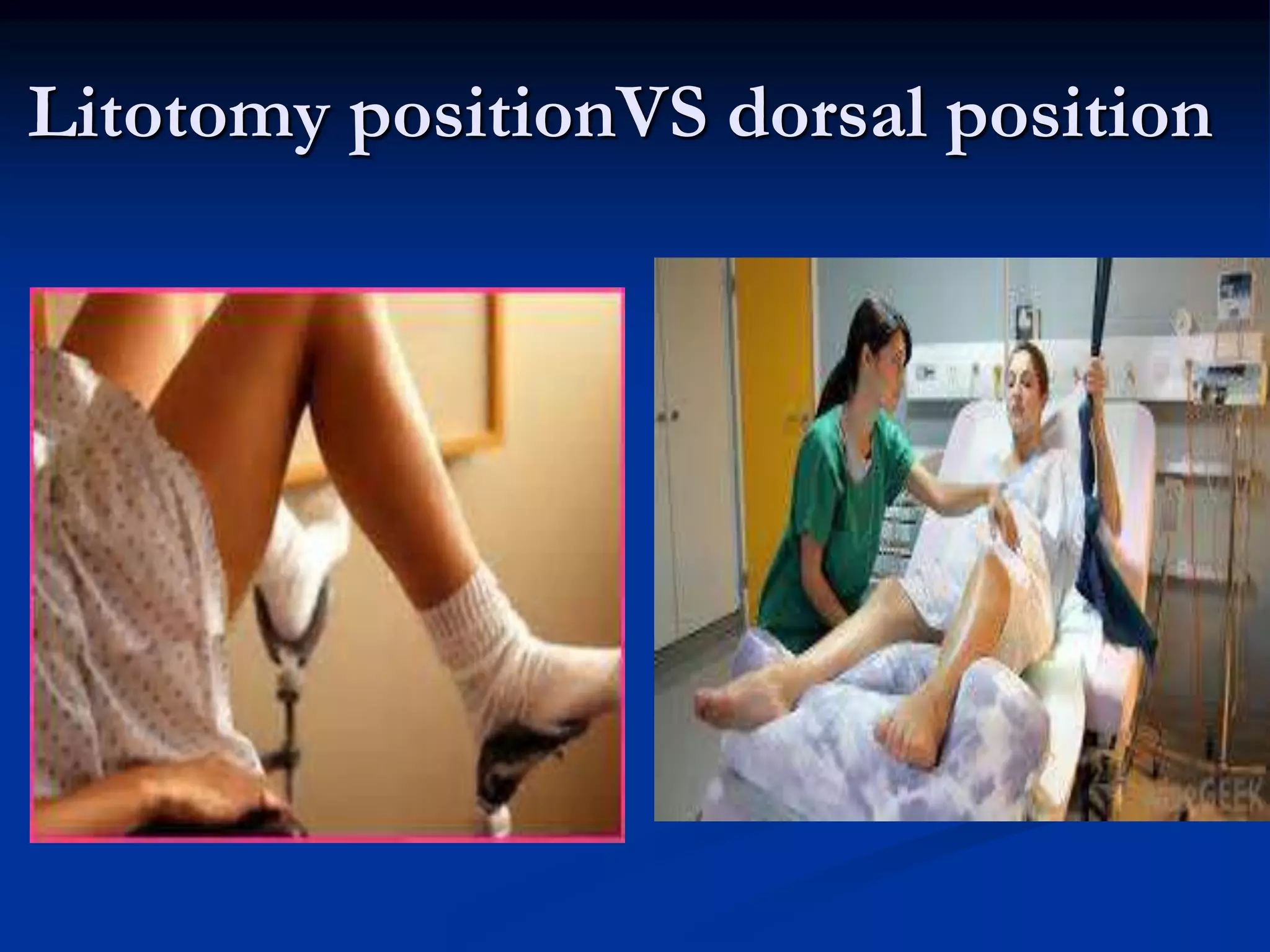 Litotomy positionVS dorsal position
 