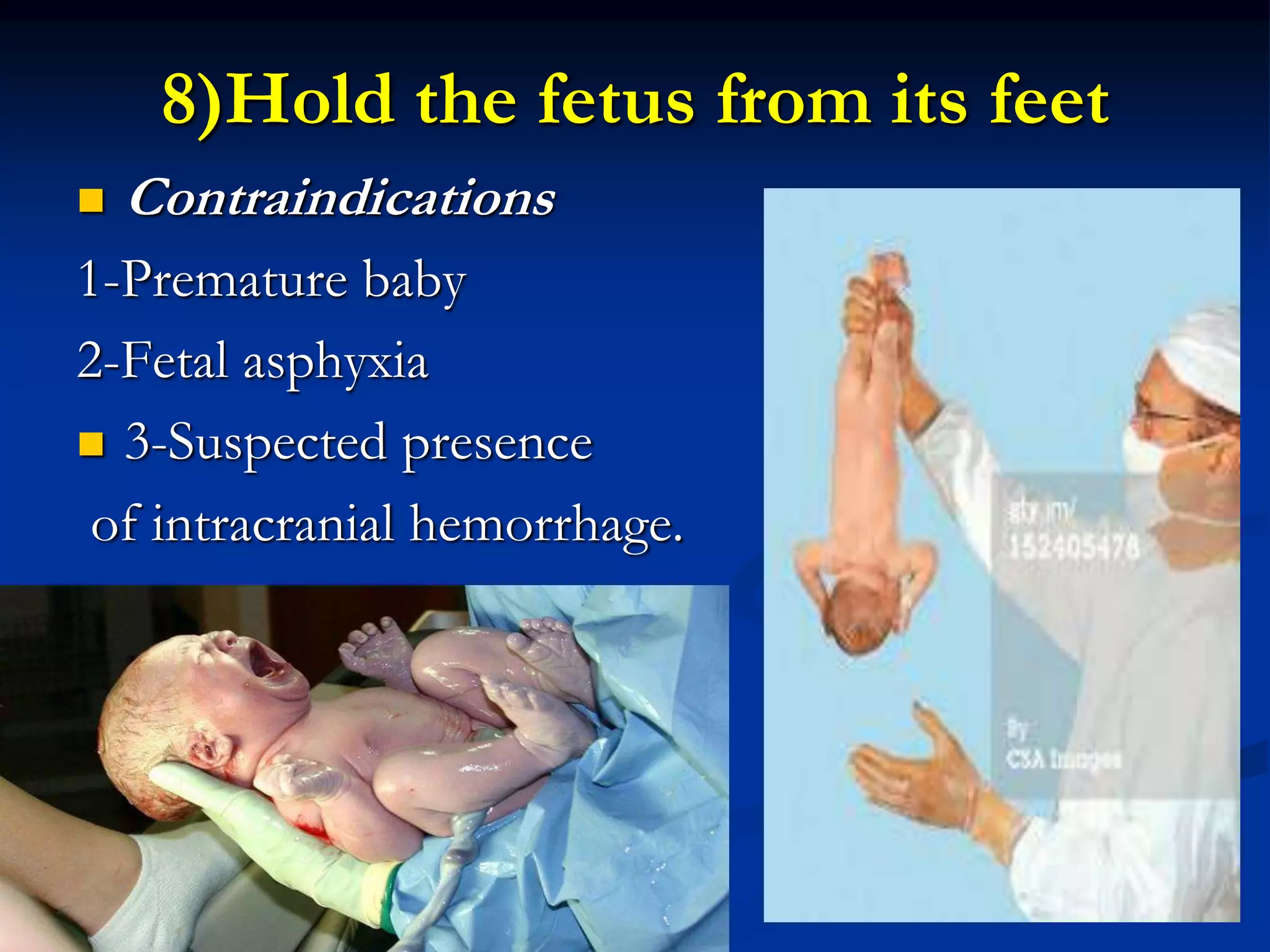 8)Hold the fetus from its feet
 Contraindications
1-Premature baby
2-Fetal asphyxia
 3-Suspected presence
of intracranial hemorrhage.
 