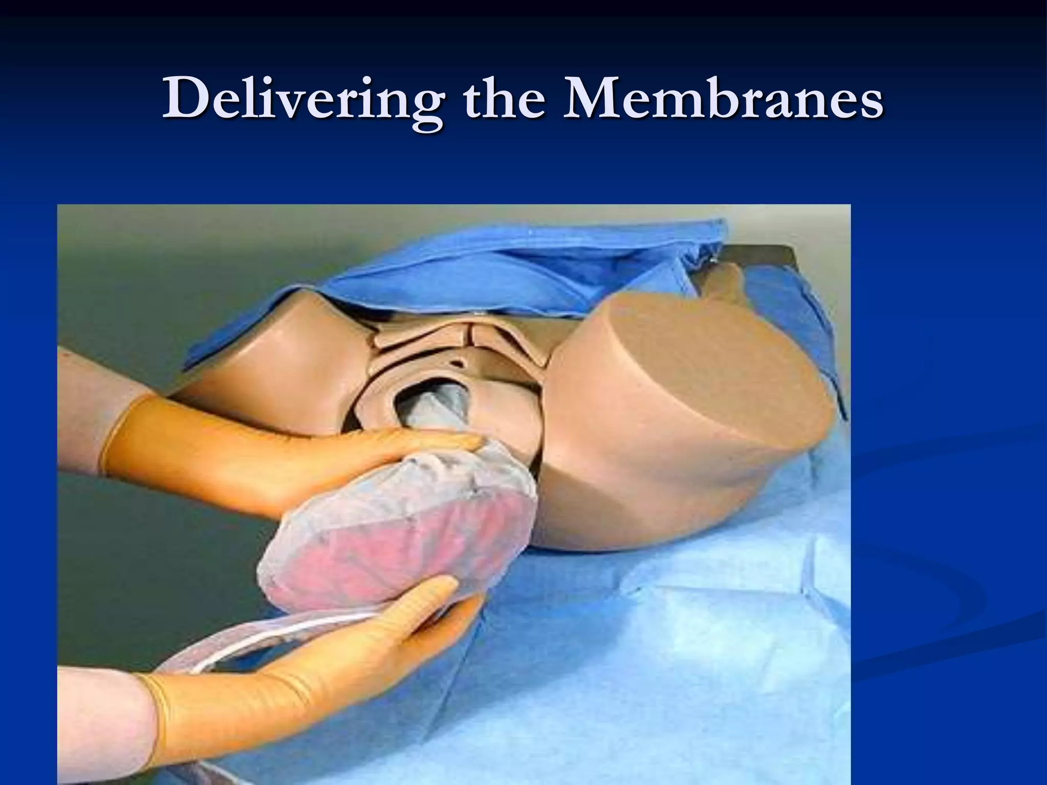 Delivering the Membranes
 