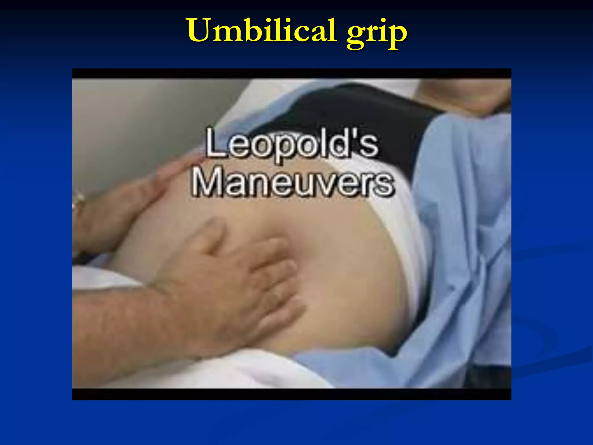 Umbilical grip
 