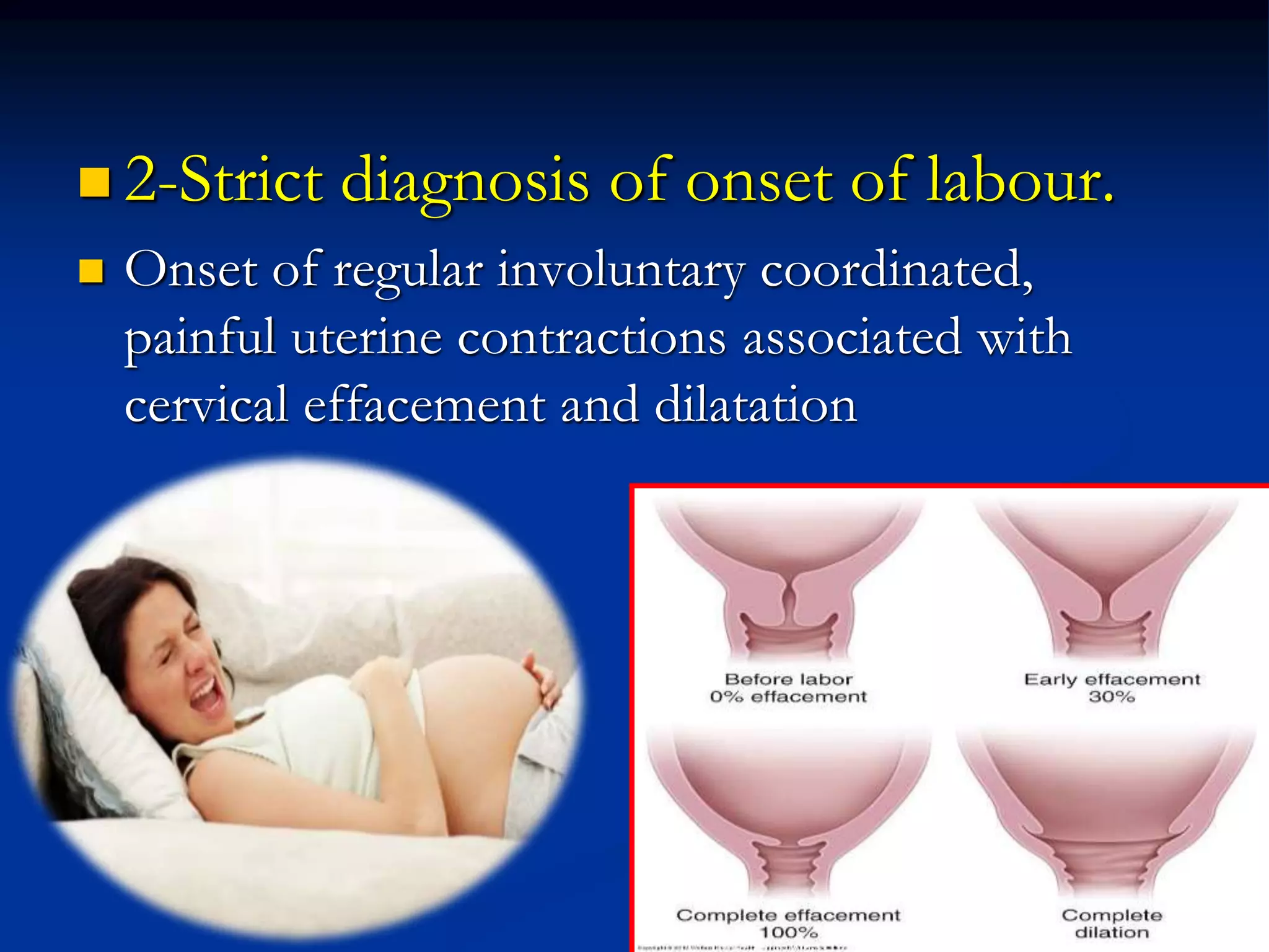  2-Strict diagnosis of onset of labour.
 Onset of regular involuntary coordinated,
painful uterine contractions associated with
cervical effacement and dilatation
 
