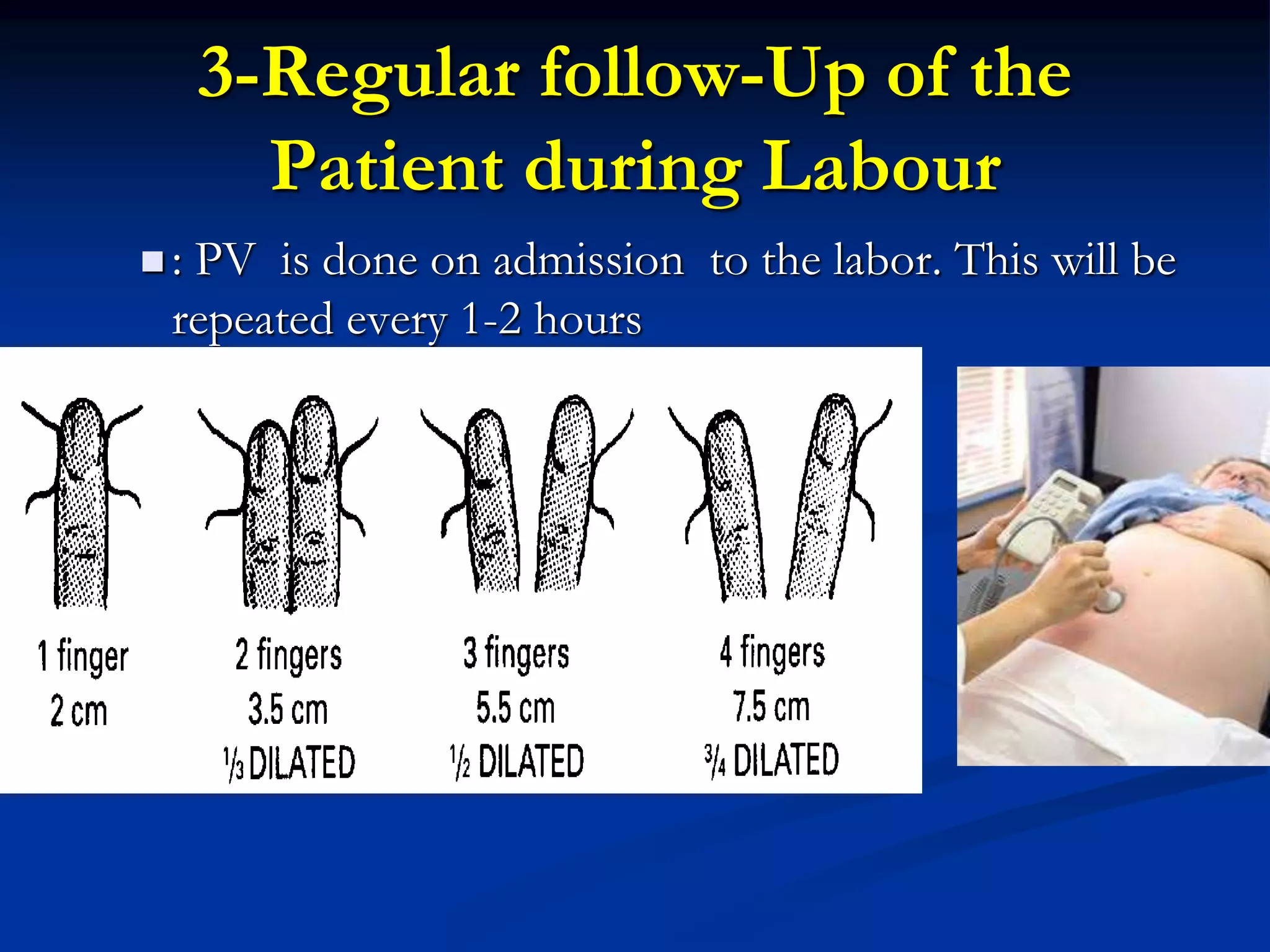 3-Regular follow-Up of the
Patient during Labour
 : PV is done on admission to the labor. This will be
repeated every 1-2 hours
 