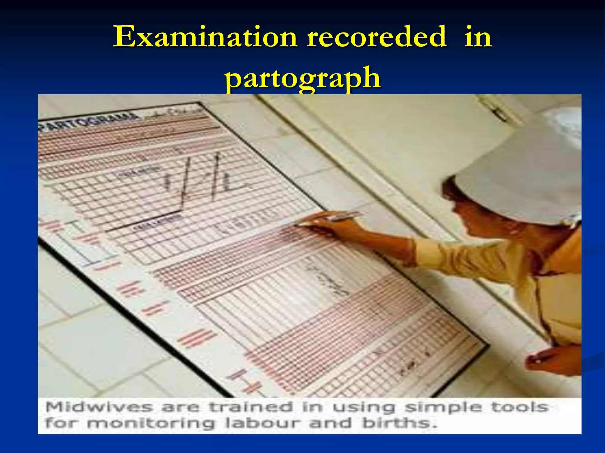 Examination recoreded in
partograph
 