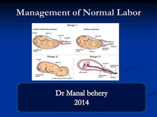 Management of Normal Labor
 