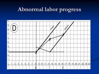 Ambulating and position in labor
 Walking may be more comfortable than being supine
during early labor
 The left lateral...